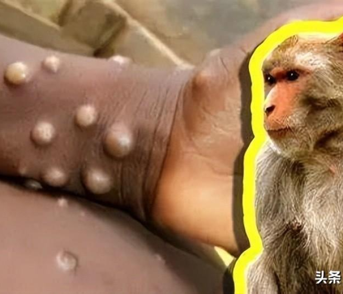 美国确诊病例超35000例了吗/美国确诊病例超过224万