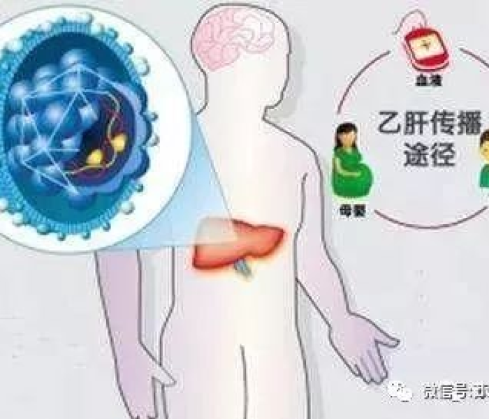 【无症状带毒者感染之后不发病仅在什么中检测到病毒/无症状带毒者是指感染之后不发病】