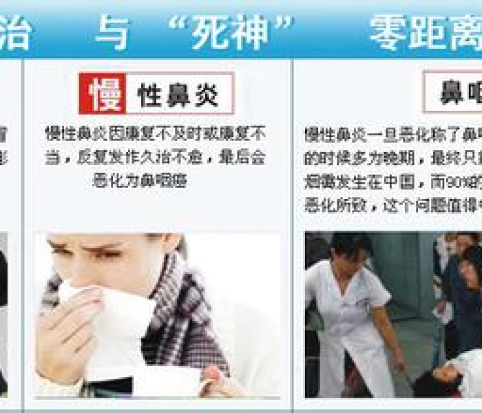 【沈阳463治疗鼻炎好吗/沈阳463是治疗什么】 【沈阳463治疗鼻炎好吗/沈阳463是治疗什么】