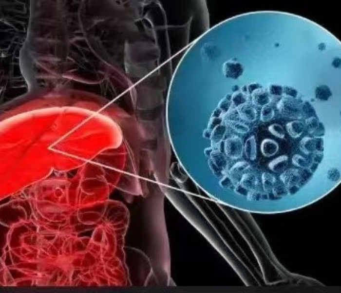 已有12国发现新型不明肝炎病人（已有12国发现新型不明肝炎病人怎么办?