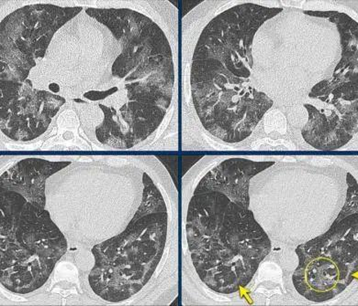全国禽流感疫情/全国禽流感疫情最新情况 全国禽流感疫情/全国禽流感疫情最新情况