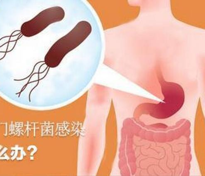 【江苏艾滋病人数2021,江苏省艾滋患者人数】