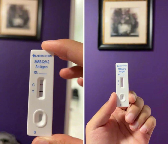 新冠患者康复期注意事项:新冠患者康复期注意事项及措施