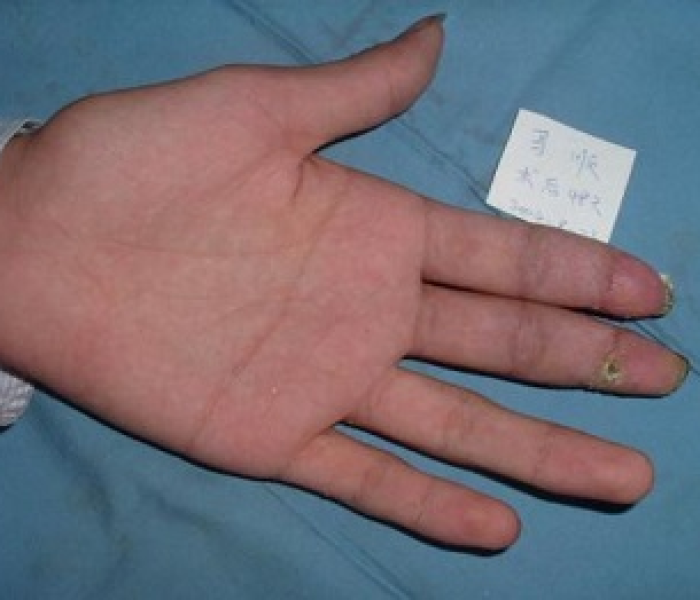 上海遣返外地人断指:上海遣送外地人