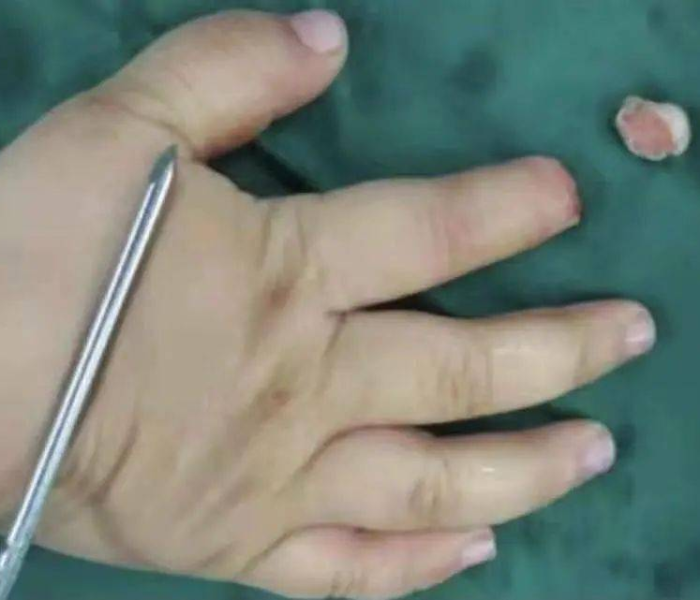 上海遣返外地人断指:上海遣送外地人