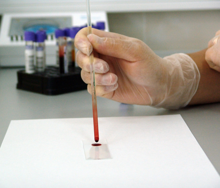 美国确诊病例已达62086例了吗/美国确诊病例升至近2万例