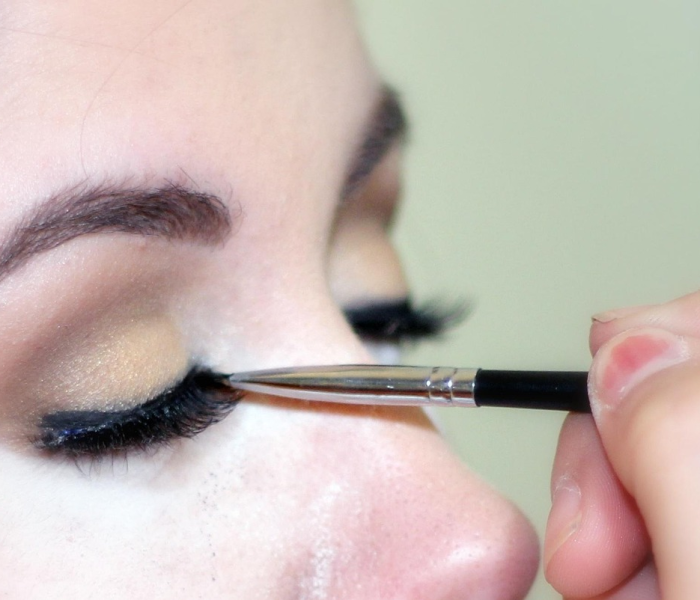 夫妻阳瘘的最佳治疗方法:夫妻阳瘘的最佳治疗方法是什么 夫妻阳瘘的最佳治疗方法:夫妻阳瘘的最佳治疗方法是什么