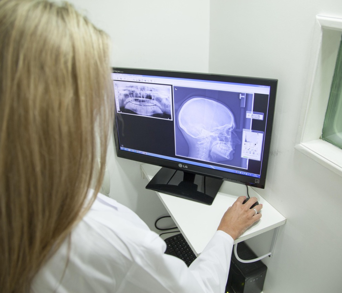 【ct值超过35,ct值395hu】