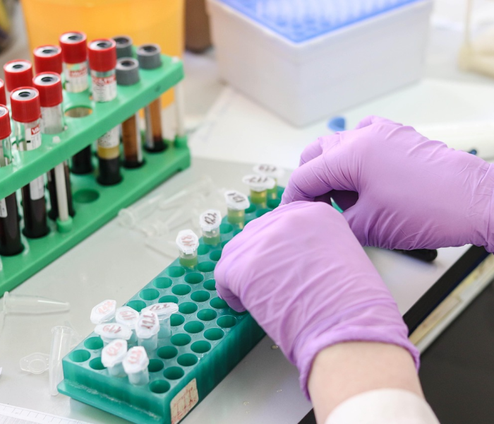 【上海部分街道开展免费核酸检测工作/上海街道医院核酸检测】