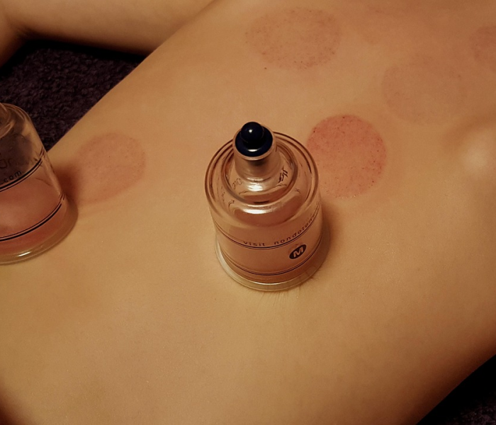 【新冠阳性有救吗,新冠阳性可以自愈吗】