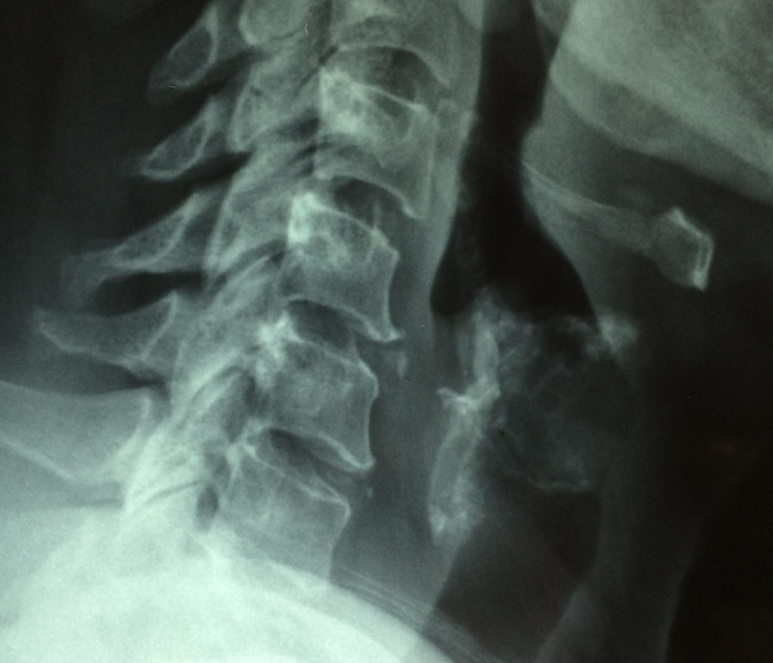 【感染科查询哪些疾病,感染科看什么病种】