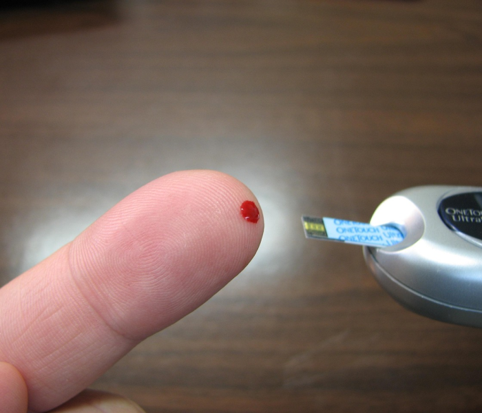 英格兰出现H5N1禽流感疫情/英格兰役情