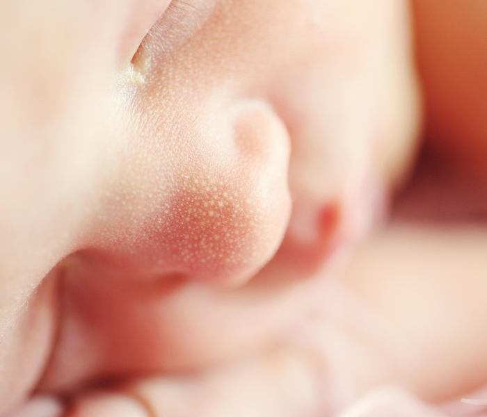 过敏体质不容易得新冠吗女性:过敏体质不容易得新冠吗女性怎么办 过敏体质不容易得新冠吗女性:过敏体质不容易得新冠吗女性怎么办